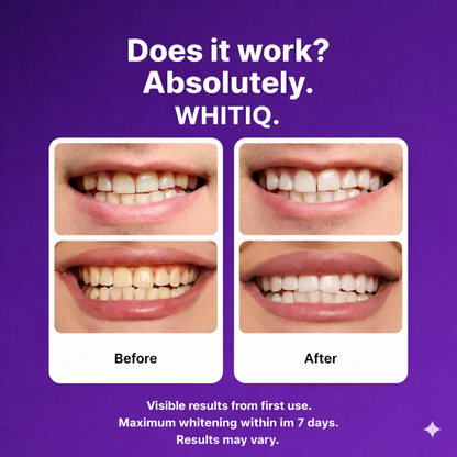 WHITIQ™ Purple Whitening Strips